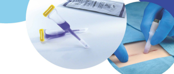 SurgiSeal Topical Skin Adhesives Brochure